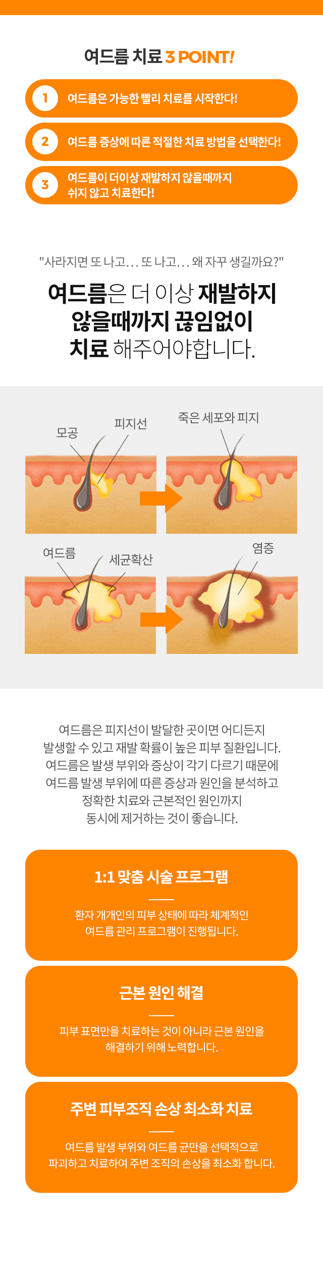 여드름치료